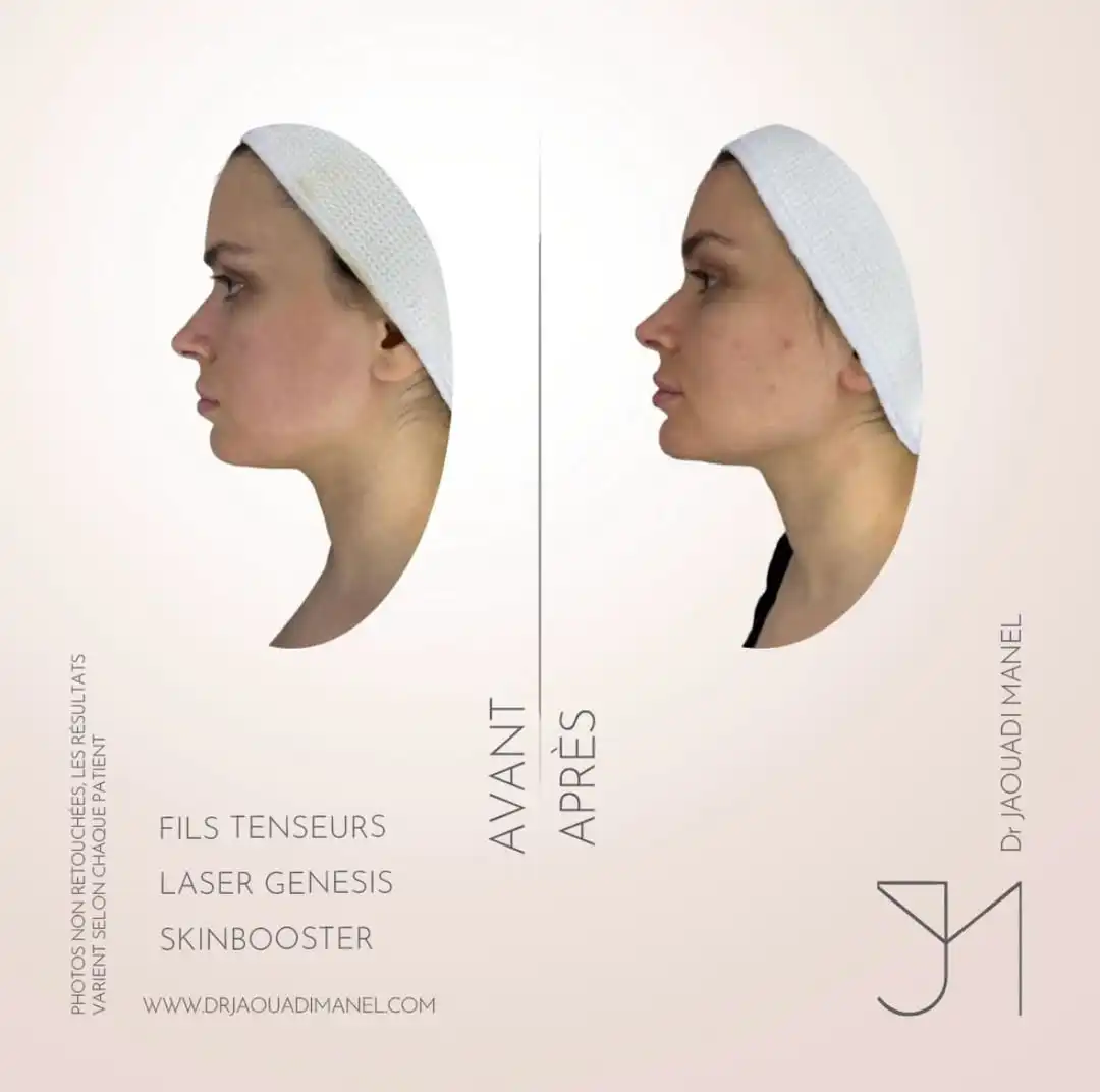 Bridal preparation is not about “more”,it’s all about subtle restraint.A softer glow.A fresher p (1)