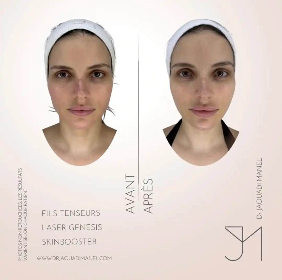 Bridal preparation is not about “more”,it’s all about subtle restraint.A softer glow.A fresher p