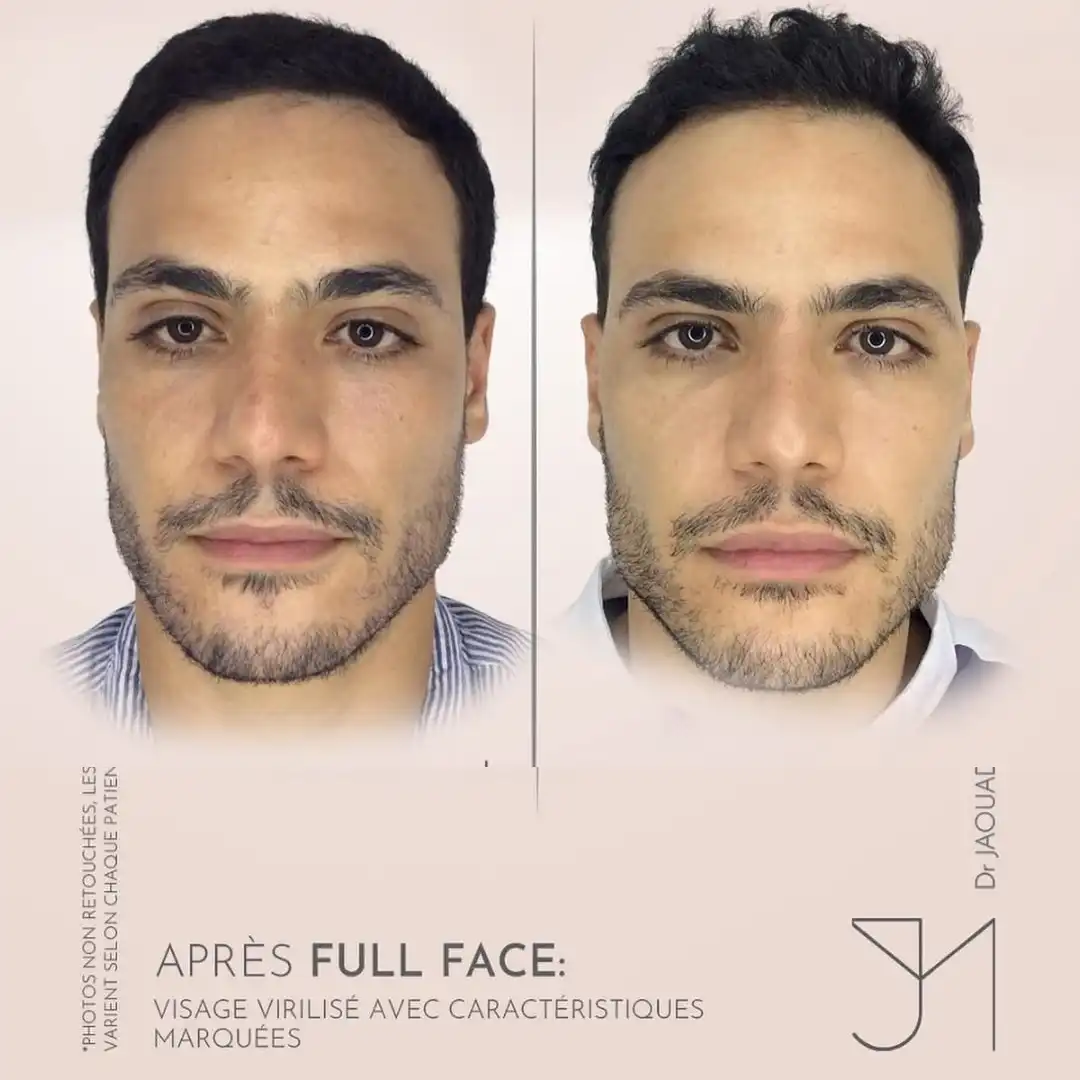Full-face-sur-