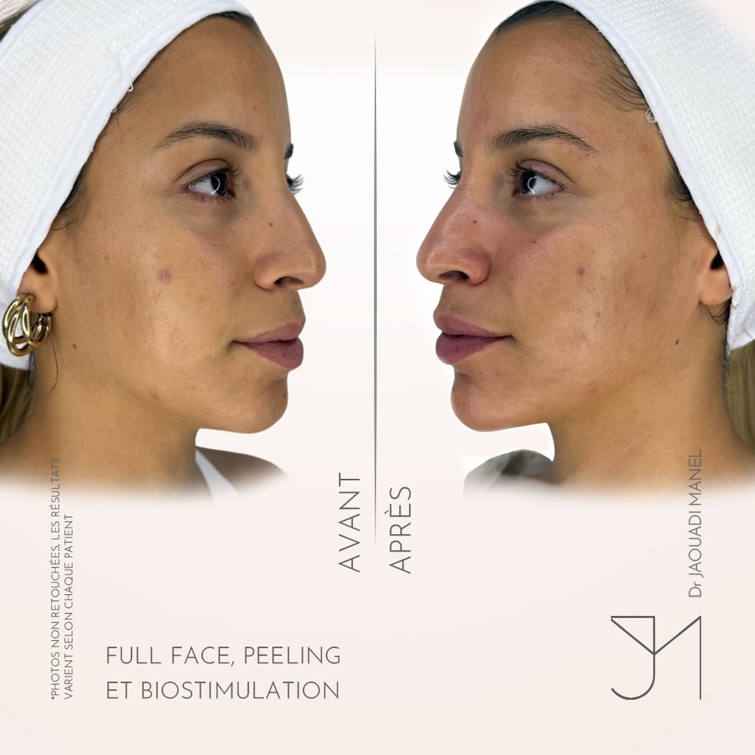 Full face sur visage fin - relief retrouvé, signature subtile et précise. Rafraîchissez votre vi (1)