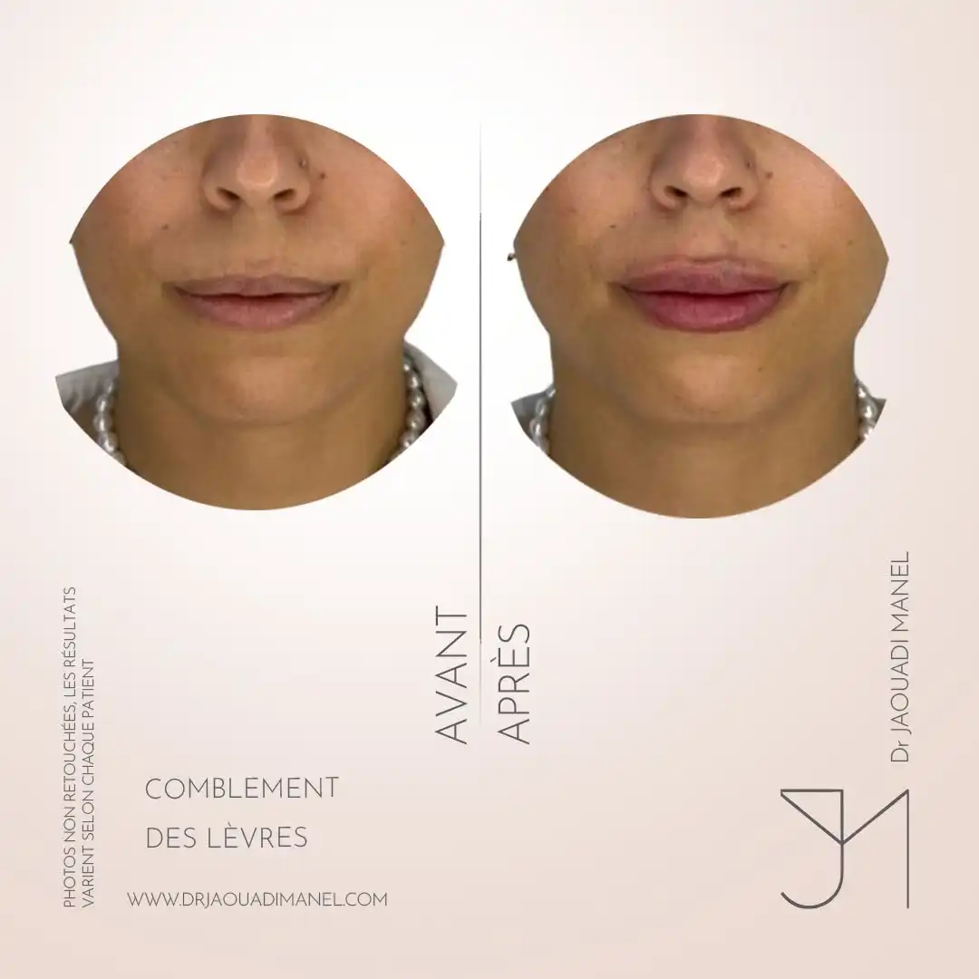 Respecter la courbe des lèvres et la dynamique du sourire, c’est animer le visage… et le maquill (3)