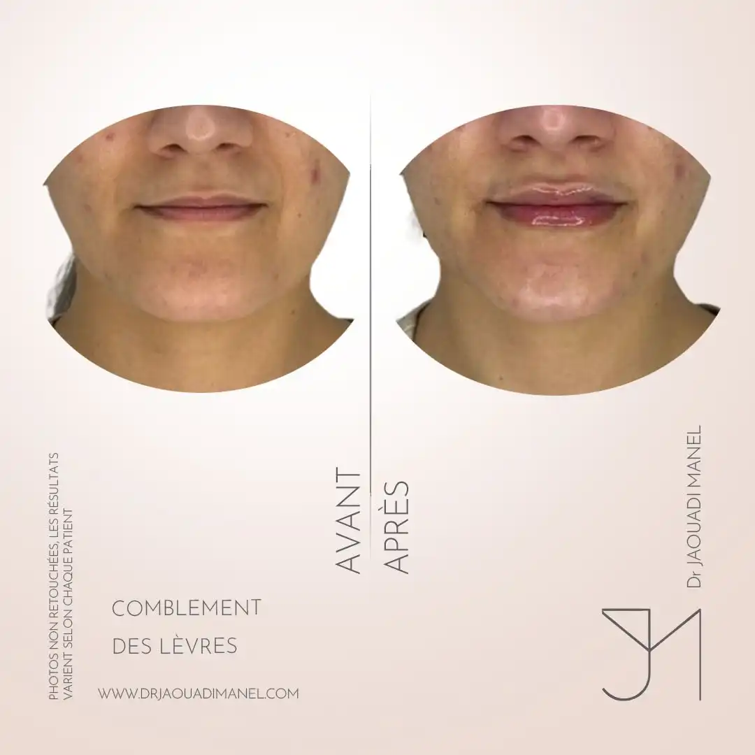 Respecter la courbe des lèvres et la dynamique du sourire, c’est animer le visage… et le maquill (4)