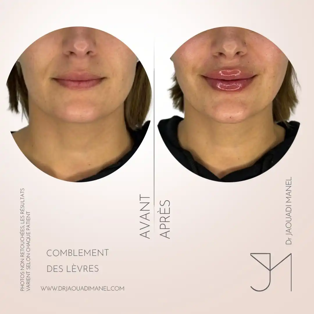 Respecter la courbe des lèvres et la dynamique du sourire, c’est animer le visage… et le maquill