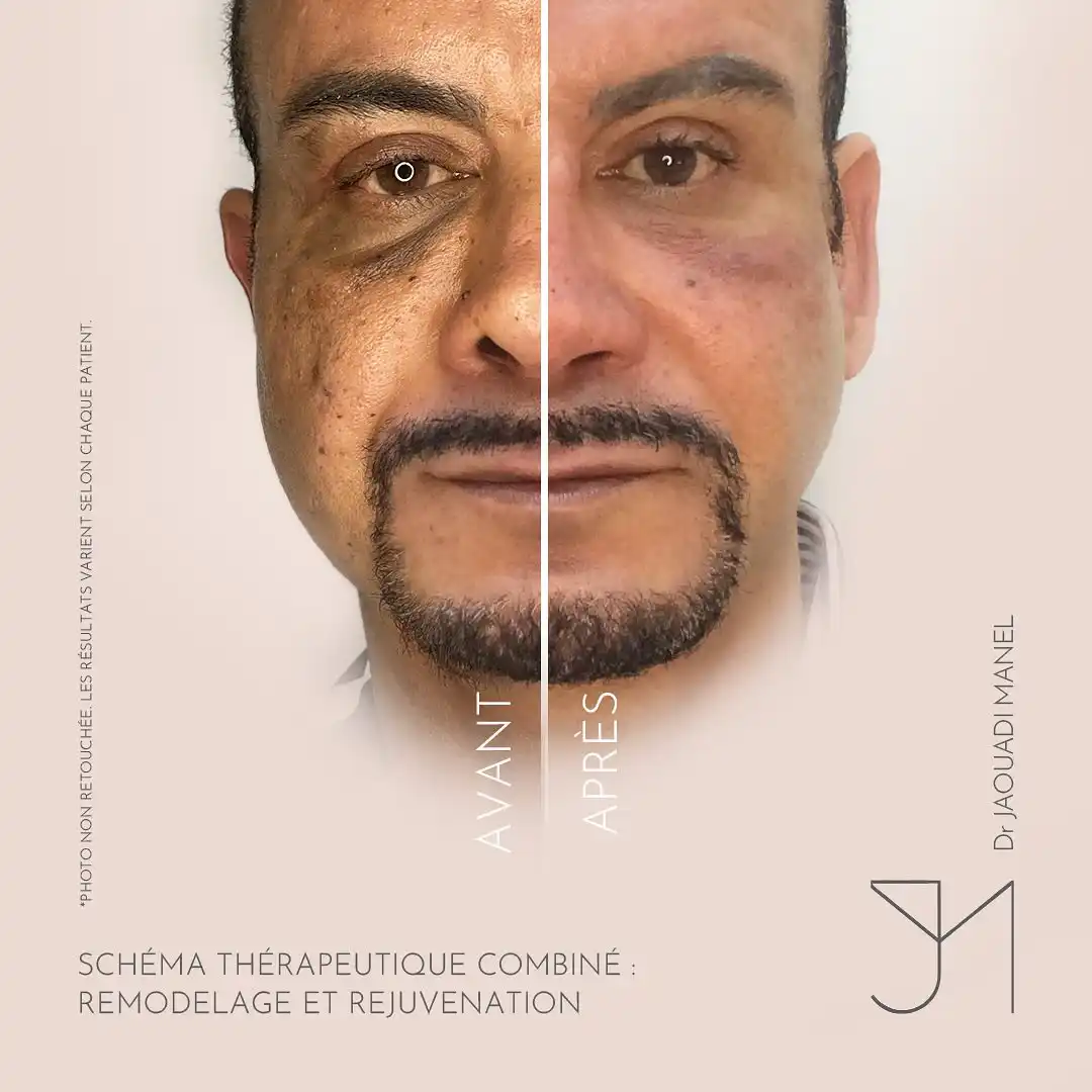 schéma thérapeutique