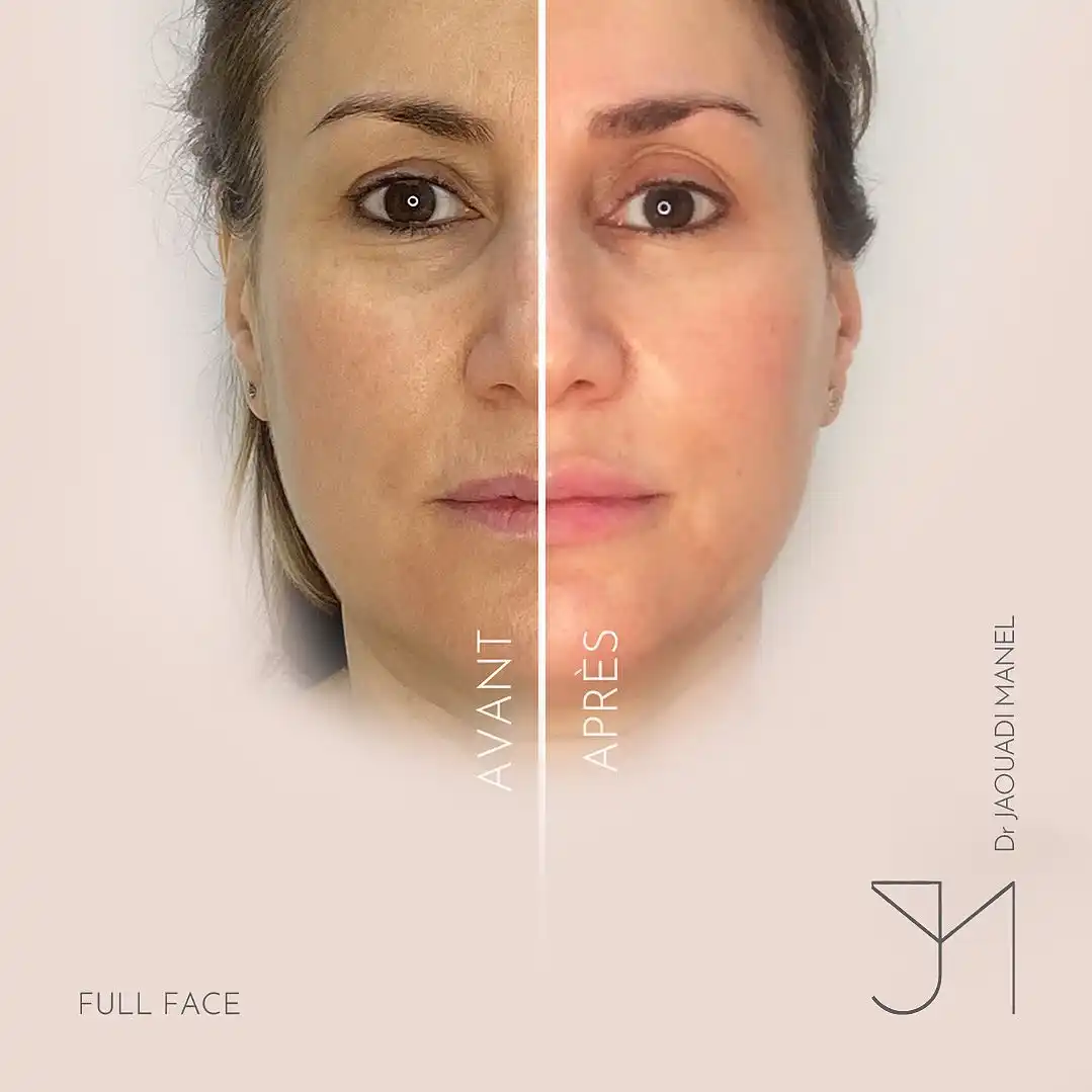 schéma thérapeutique1