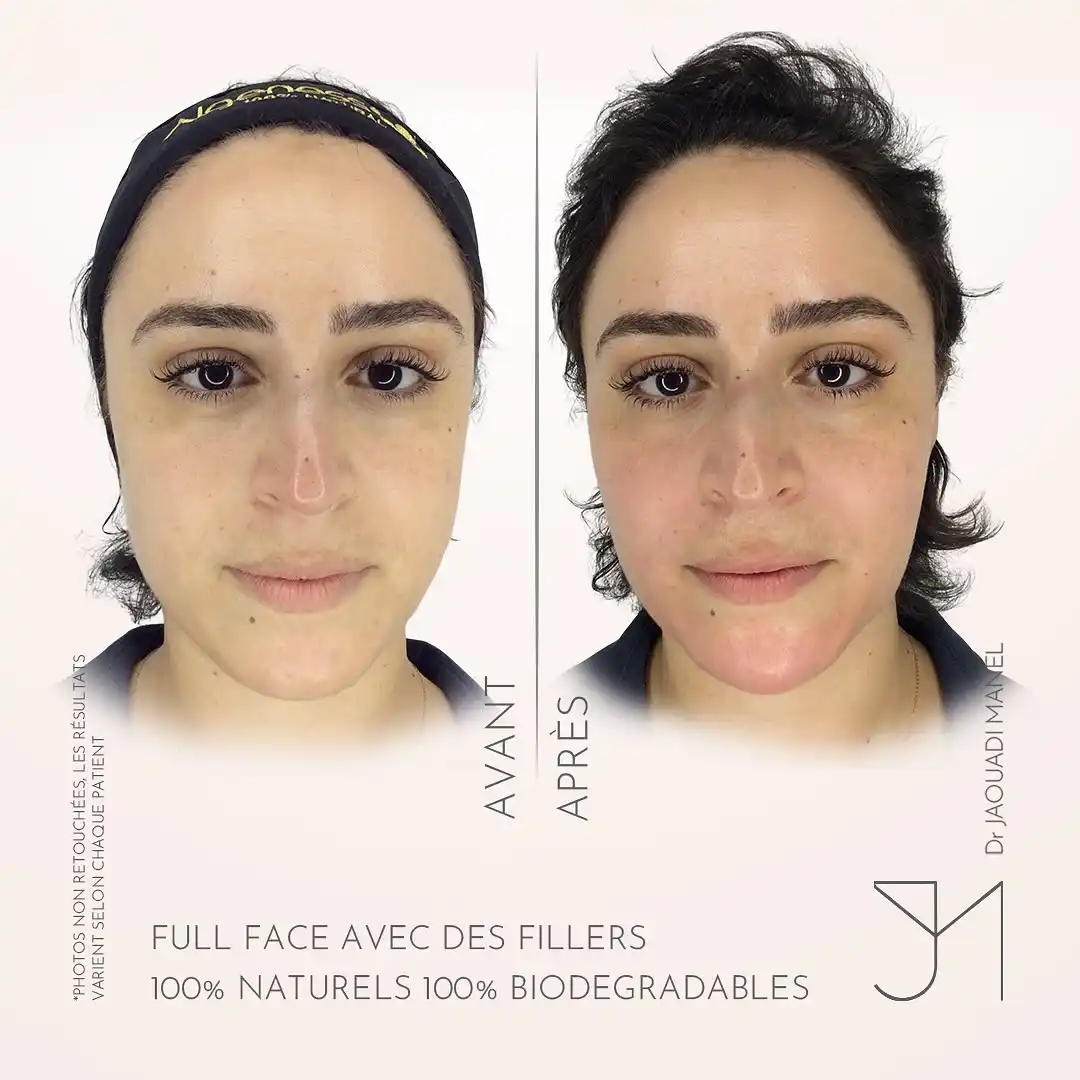 schéma thérapeutique2