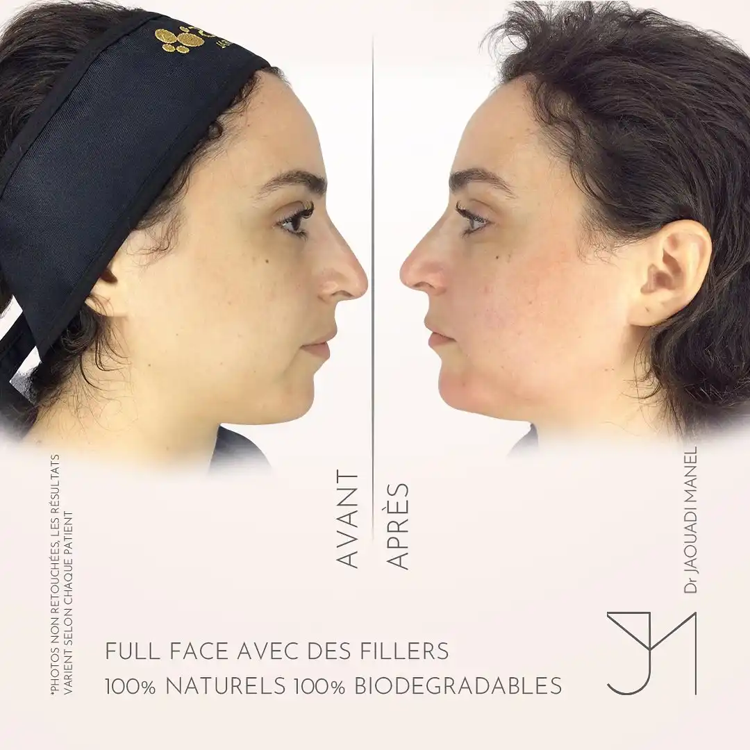 schéma thérapeutique3