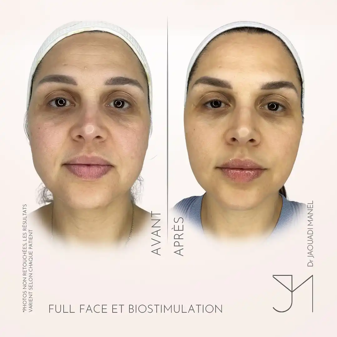 schéma thérapeutique4