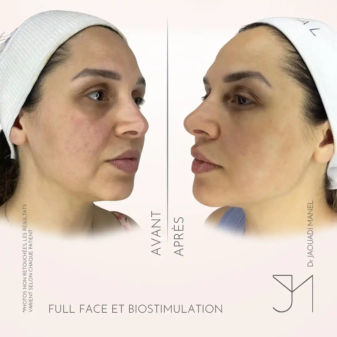 schéma thérapeutique5